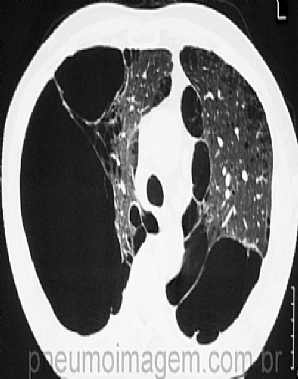 LAN�ADA A VERS�O 2014 DO DOCUMENTO